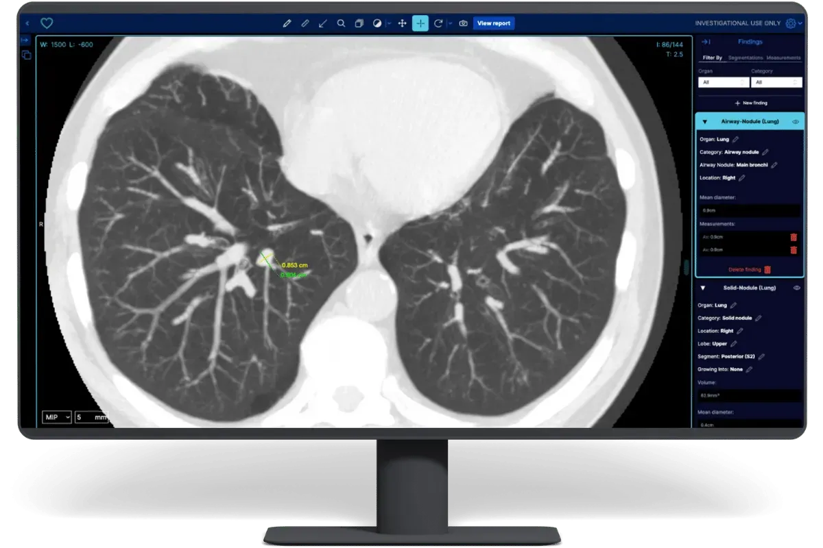 Estonia-based Better Medicine raises €1M for its AI-powered detection tool for kidney cancer Post feature image